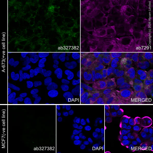 Immunocytochemistry/ Immunofluorescence - Anti-Ten-1 antibody [EPR29567-15] - C-terminal (AB327382)