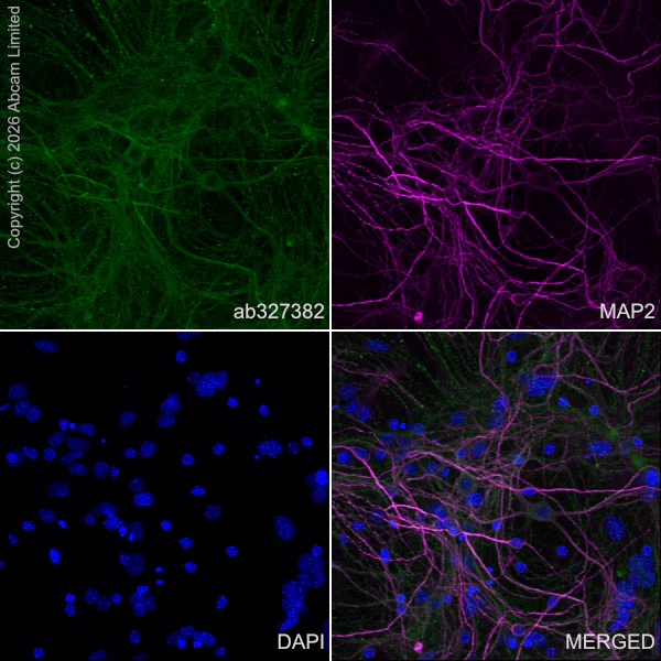 Immunocytochemistry/ Immunofluorescence - Anti-Ten-1 antibody [EPR29567-15] - C-terminal (AB327382)
