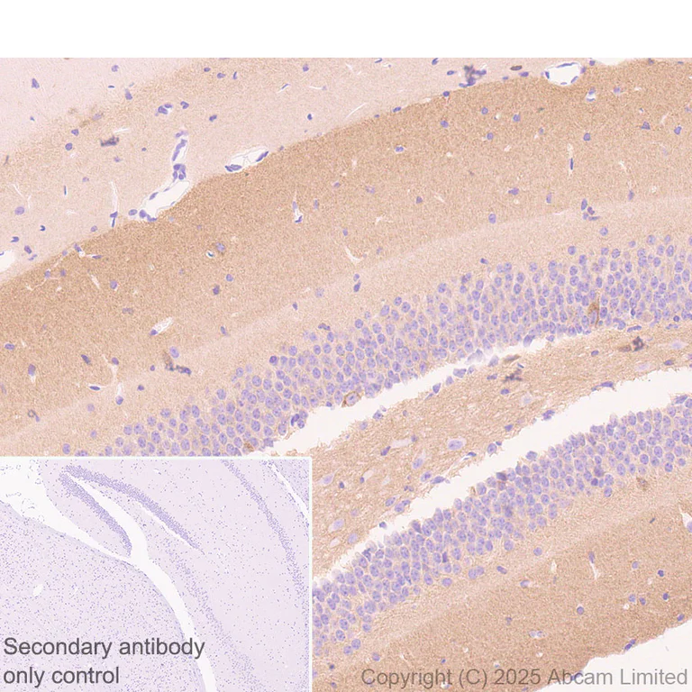 Immunohistochemistry (Formalin/PFA-fixed paraffin-embedded sections) - Anti-Ten-1 antibody [EPR29567-35] - C-terminal (AB325392)