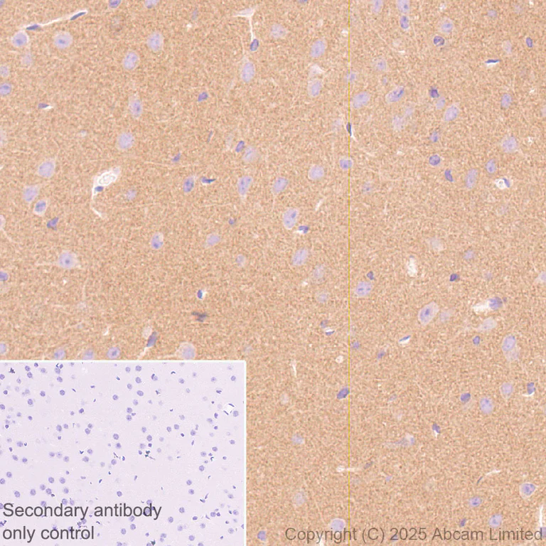 Immunohistochemistry (Formalin/PFA-fixed paraffin-embedded sections) - Anti-Ten-1 antibody [EPR29567-35] - C-terminal (AB325392)