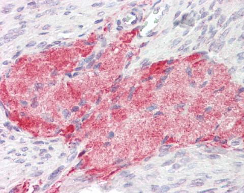 Immunohistochemistry (Formalin/PFA-fixed paraffin-embedded sections) - Anti-Tenascin C antibody - C-terminal (AB226916)