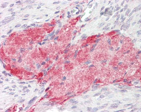 Immunohistochemistry (Formalin/PFA-fixed paraffin-embedded sections) - Anti-Tenascin C antibody - C-terminal (AB226916)