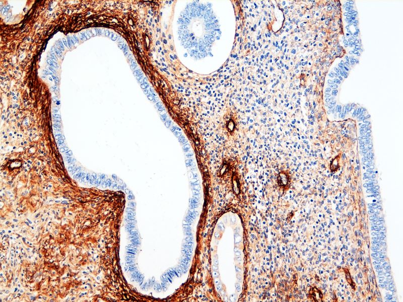 Immunohistochemistry (Formalin/PFA-fixed paraffin-embedded sections) - Anti-Tenascin C antibody [DB7] (AB86182)