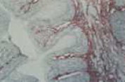 Immunohistochemistry (Frozen sections) - Anti-Tenascin C antibody [EB2] (AB88280), expandable thumbnail