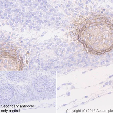 Immunohistochemistry (Formalin/PFA-fixed paraffin-embedded sections) - Anti-Tenascin C antibody [EPR4219] (AB108930)