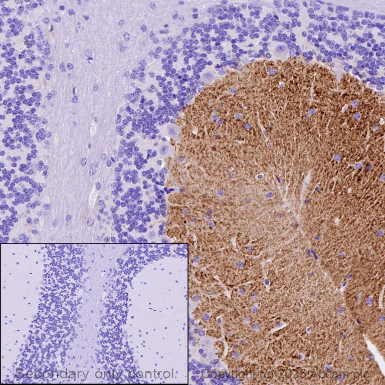 Immunohistochemistry (Formalin/PFA-fixed paraffin-embedded sections) - Anti-Tenascin C antibody [EPR4219] (AB108930)