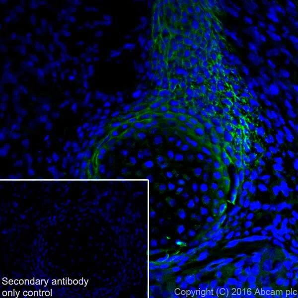 Immunohistochemistry (Frozen sections) - Anti-Tenascin C antibody [EPR4219] (AB108930)