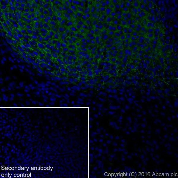 Immunohistochemistry (Frozen sections) - Anti-Tenascin C antibody [EPR4219] (AB108930)