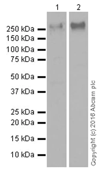 Western blot - Anti-Tenascin C antibody [EPR4219] (AB108930)