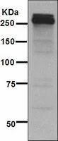 Western blot - Anti-Tenascin C antibody [EPR4219] (AB108930)