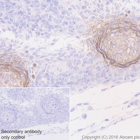 Immunohistochemistry (Formalin/PFA-fixed paraffin-embedded sections) - Anti-Tenascin C antibody [EPR4219] - BSA and Azide free (AB271877), expandable thumbnail