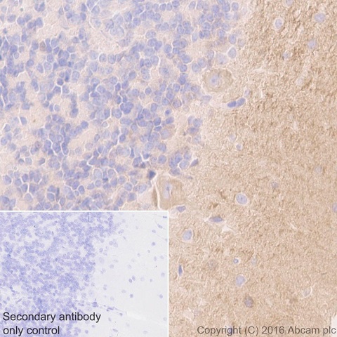 Immunohistochemistry (Formalin/PFA-fixed paraffin-embedded sections) - Anti-Tenascin C antibody [EPR4219] - BSA and Azide free (AB271877), expandable thumbnail