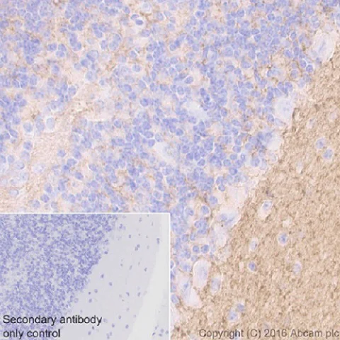 Immunohistochemistry (Formalin/PFA-fixed paraffin-embedded sections) - Anti-Tenascin C antibody [EPR4219] - BSA and Azide free (AB271877)