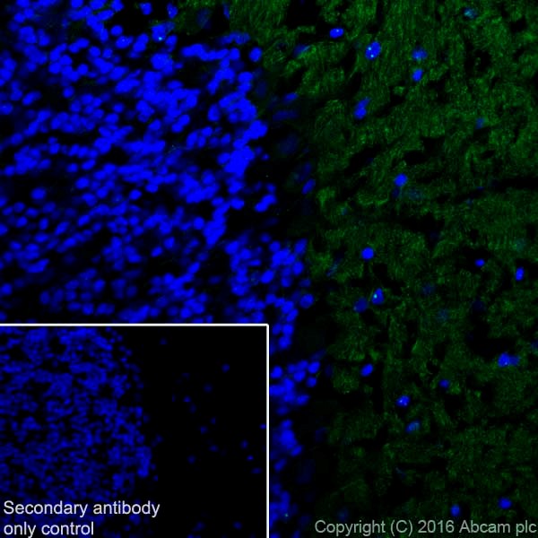 Immunohistochemistry (Frozen sections) - Anti-Tenascin C antibody [EPR4219] - BSA and Azide free (AB271877), expandable thumbnail