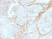 Immunohistochemistry (Formalin/PFA-fixed paraffin-embedded sections) - Anti-Tenascin C antibody [SPM319] - BSA and Azide free (AB212463)