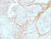 Immunohistochemistry (Formalin/PFA-fixed paraffin-embedded sections) - Anti-Tenascin C antibody [SPM319] - BSA and Azide free (AB212463)