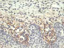 Immunohistochemistry (Formalin/PFA-fixed paraffin-embedded sections) - Anti-Tenascin C antibody [T2H5] (AB3970)