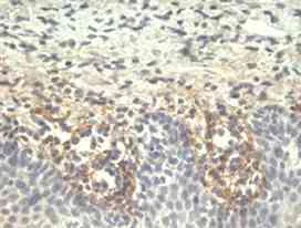 Immunohistochemistry (Formalin/PFA-fixed paraffin-embedded sections) - Anti-Tenascin C antibody [T2H5] (AB3970)