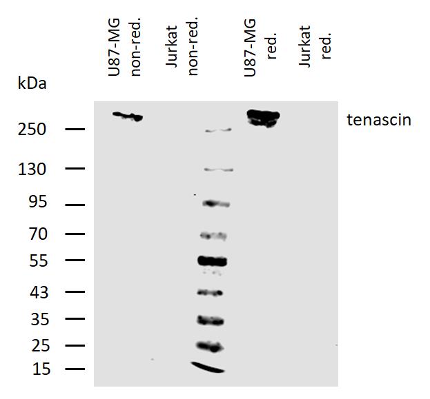 Western blot - Anti-Tenascin C antibody [T2H5] (AB3970)