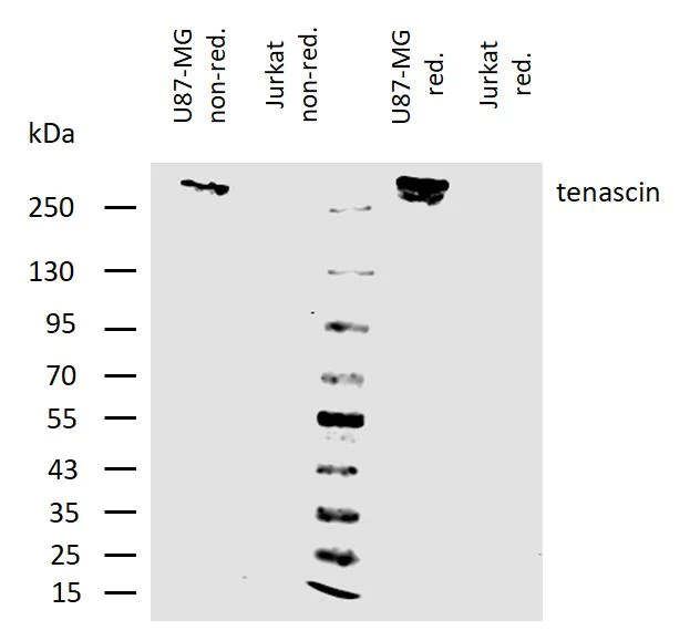 Western blot - Anti-Tenascin C antibody [T2H5] (AB3970)