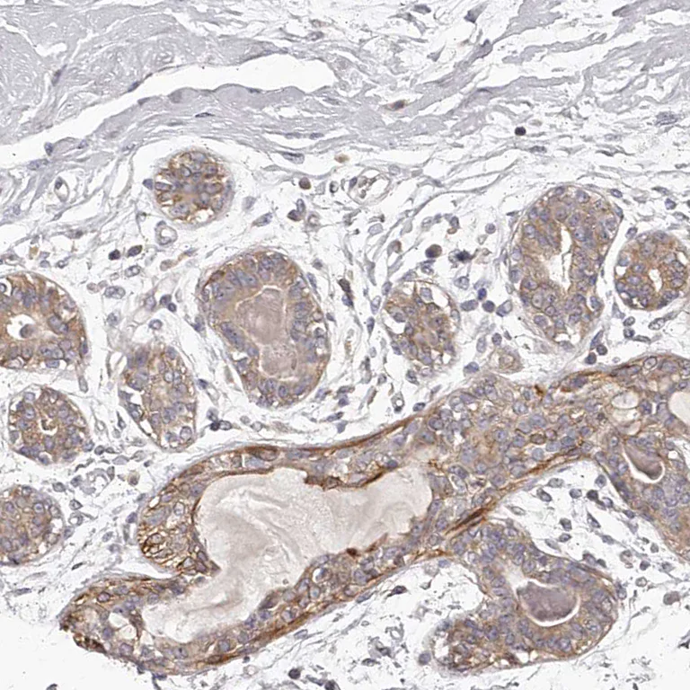 Immunohistochemistry (Formalin/PFA-fixed paraffin-embedded sections) - Anti-Tenascin-N antibody (AB121887)