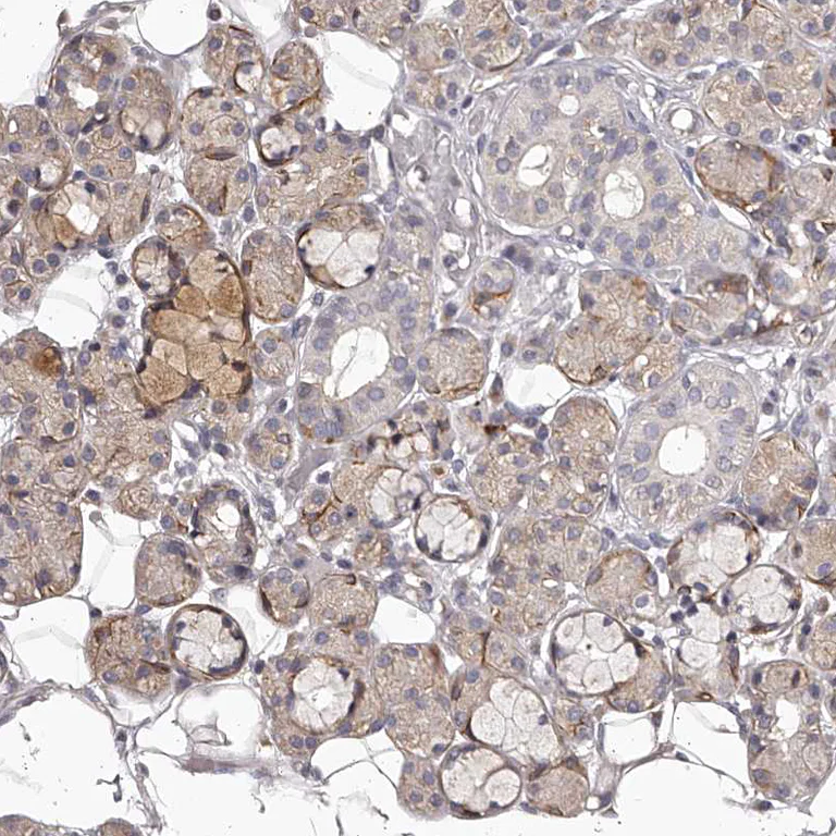 Immunohistochemistry (Formalin/PFA-fixed paraffin-embedded sections) - Anti-Tenascin-N antibody (AB121887)