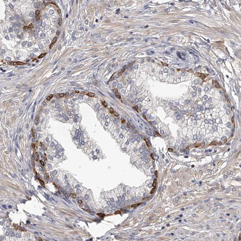 Immunohistochemistry (Formalin/PFA-fixed paraffin-embedded sections) - Anti-Tenascin-N antibody (AB121887)