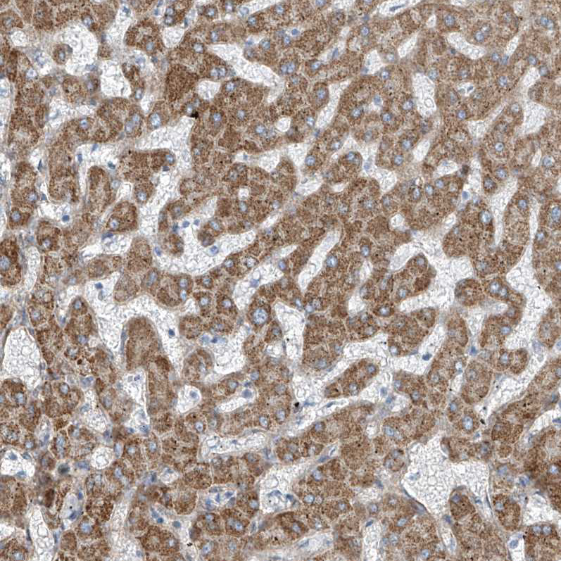 Immunohistochemistry (Formalin/PFA-fixed paraffin-embedded sections) - Anti-TENC1/Tensin-2 antibody (AB251825), expandable thumbnail