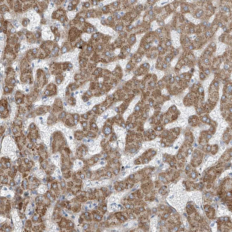 Immunohistochemistry (Formalin/PFA-fixed paraffin-embedded sections) - Anti-TENC1/Tensin-2 antibody (AB251825)
