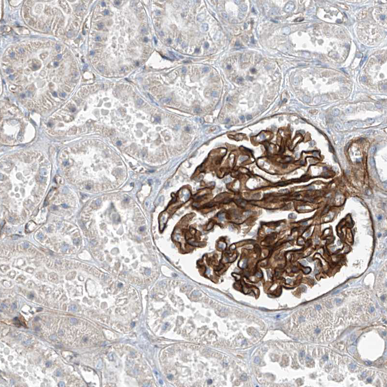 Immunohistochemistry (Formalin/PFA-fixed paraffin-embedded sections) - Anti-TENC1/Tensin-2 antibody (AB251825), expandable thumbnail