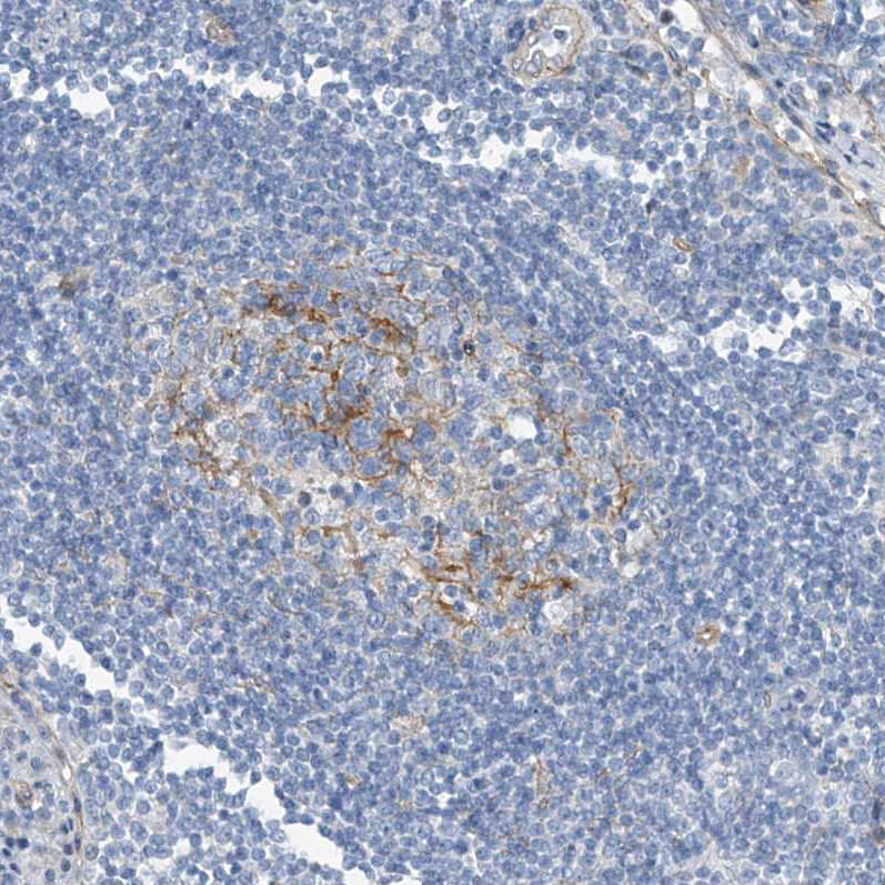 Immunohistochemistry (Formalin/PFA-fixed paraffin-embedded sections) - Anti-TENC1/Tensin-2 antibody (AB251825), expandable thumbnail