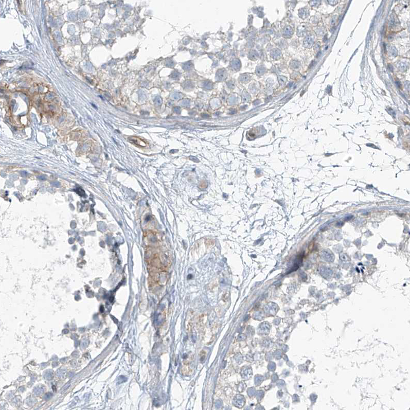 Immunohistochemistry (Formalin/PFA-fixed paraffin-embedded sections) - Anti-TENC1/Tensin-2 antibody (AB251825), expandable thumbnail