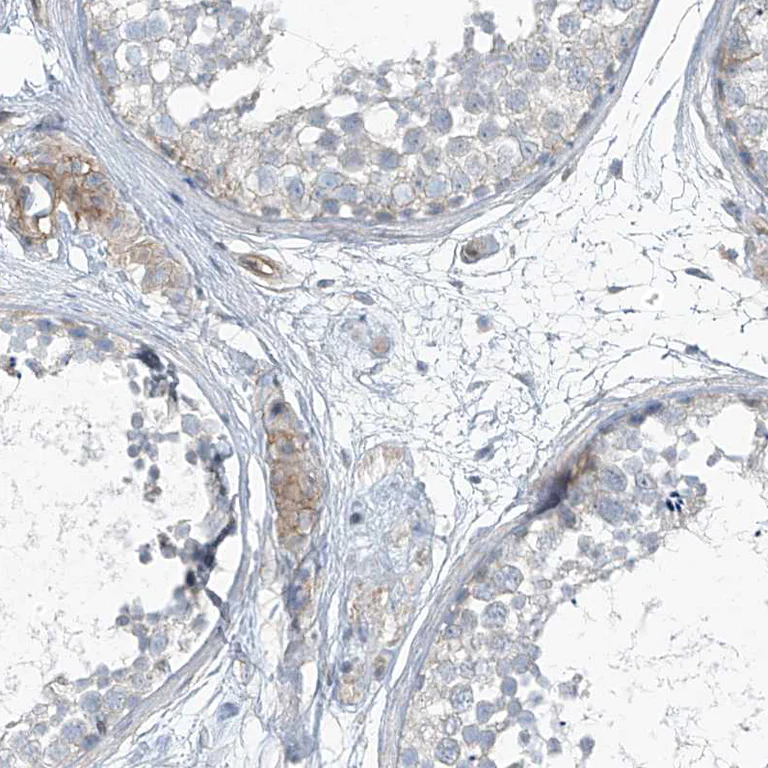 Immunohistochemistry (Formalin/PFA-fixed paraffin-embedded sections) - Anti-TENC1/Tensin-2 antibody (AB251825)