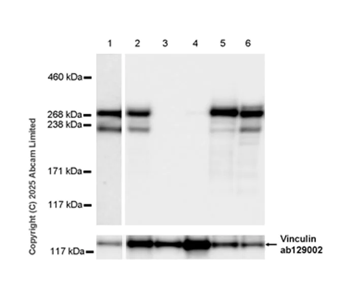 Western blot - Anti-Teneurin-2 (C-terminal) antibody [EPR29568-575] (AB325134)