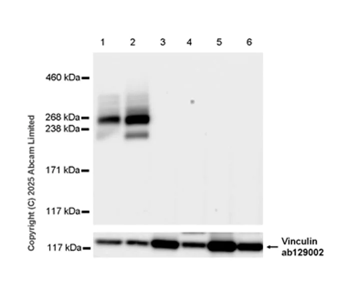 Western blot - Anti-Teneurin-2 (C-terminal) antibody [EPR29568-575] (AB325134)