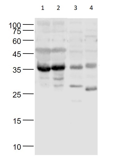 Western blot - Anti-tenomodulin antibody (AB203676)