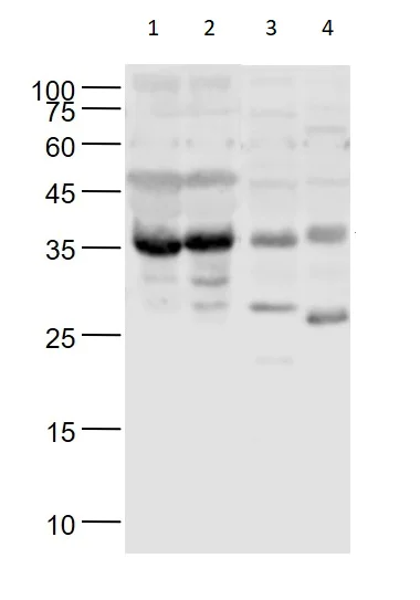 Western blot - Anti-tenomodulin antibody (AB203676)