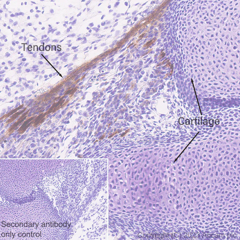 Immunohistochemistry (Formalin/PFA-fixed paraffin-embedded sections) - Anti-tenomodulin antibody [EPR27069-160] (AB315996)