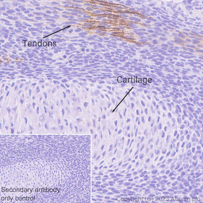 Immunohistochemistry (Formalin/PFA-fixed paraffin-embedded sections) - Anti-tenomodulin antibody [EPR27069-160] (AB315996)