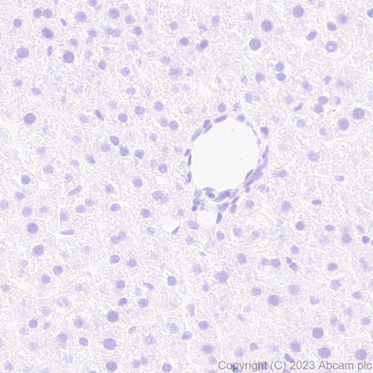 Immunohistochemistry (Formalin/PFA-fixed paraffin-embedded sections) - Anti-tenomodulin antibody [EPR27069-160] (AB315996)