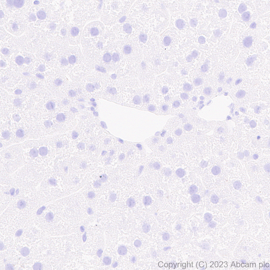 Immunohistochemistry (Formalin/PFA-fixed paraffin-embedded sections) - Anti-tenomodulin antibody [EPR27069-160] (AB315996)
