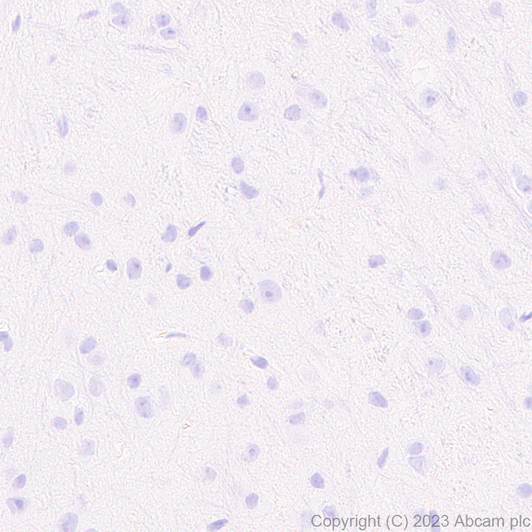 Immunohistochemistry (Formalin/PFA-fixed paraffin-embedded sections) - Anti-tenomodulin antibody [EPR27069-160] - BSA and Azide free (AB315997)