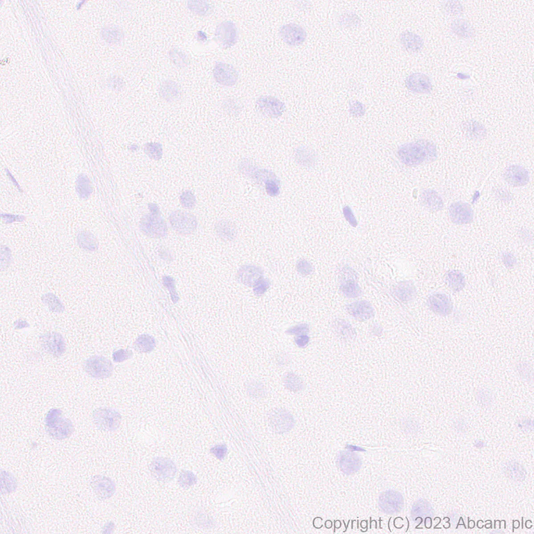 Immunohistochemistry (Formalin/PFA-fixed paraffin-embedded sections) - Anti-tenomodulin antibody [EPR27069-160] - BSA and Azide free (AB315997)
