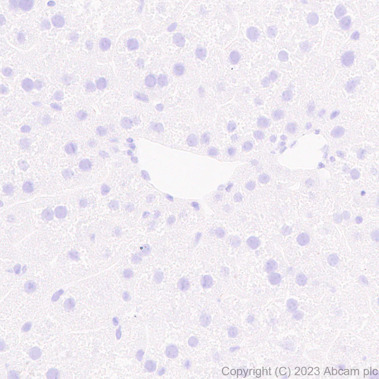Immunohistochemistry (Formalin/PFA-fixed paraffin-embedded sections) - Anti-tenomodulin antibody [EPR27069-160] - BSA and Azide free (AB315997)
