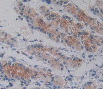 Immunohistochemistry (Formalin/PFA-fixed paraffin-embedded sections) - Anti-Tensin 1 antibody (AB233133)