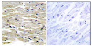 Immunohistochemistry (Formalin/PFA-fixed paraffin-embedded sections) - Anti-Tensin 3 antibody (AB178554)