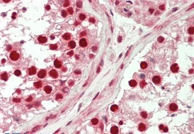Immunohistochemistry (Formalin/PFA-fixed paraffin-embedded sections) - Anti-TESK2 antibody (AB230644)