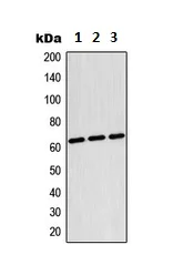 Western blot - Anti-TESK2 antibody (AB230644)