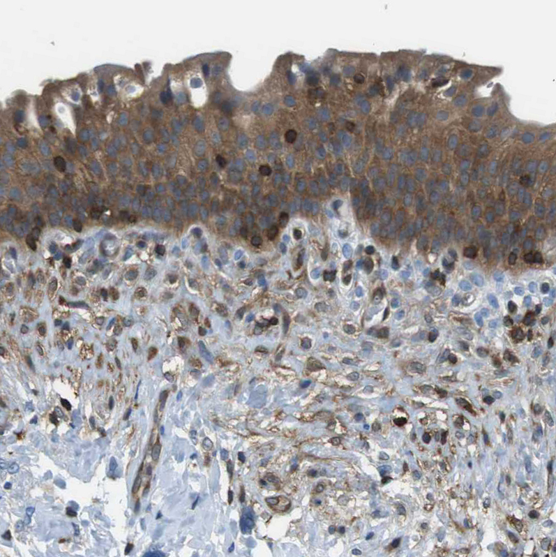 Immunohistochemistry (Formalin/PFA-fixed paraffin-embedded sections) - Anti-Testin antibody (AB224375)