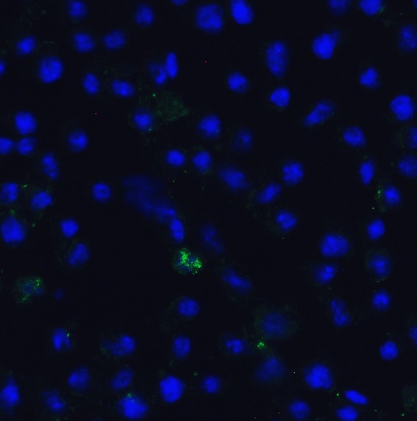 Immunocytochemistry/ Immunofluorescence - Anti-TET1 antibody - C-terminal (ab191698), expandable thumbnail